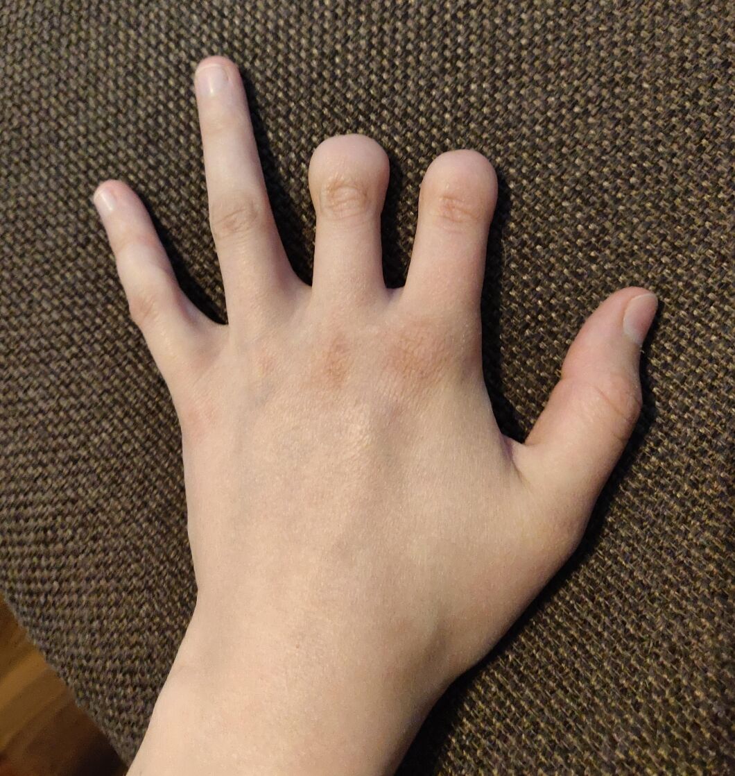 Are Short Fingers Bad for Piano