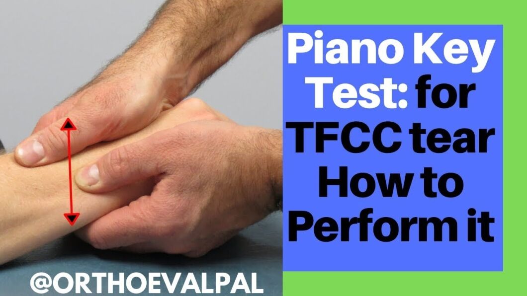 What is Piano Key Sign