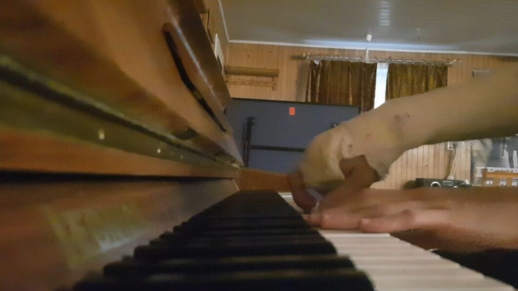 Can You Play Piano With a Broken Wrist